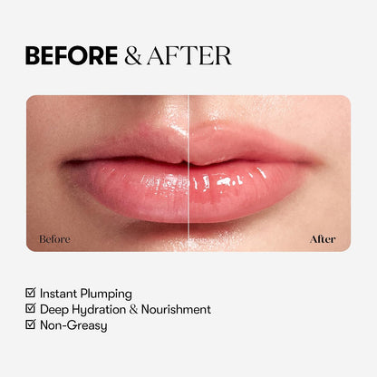 VT COSMETICS Reedle Shot Lip Plumper Beginner - 4ml